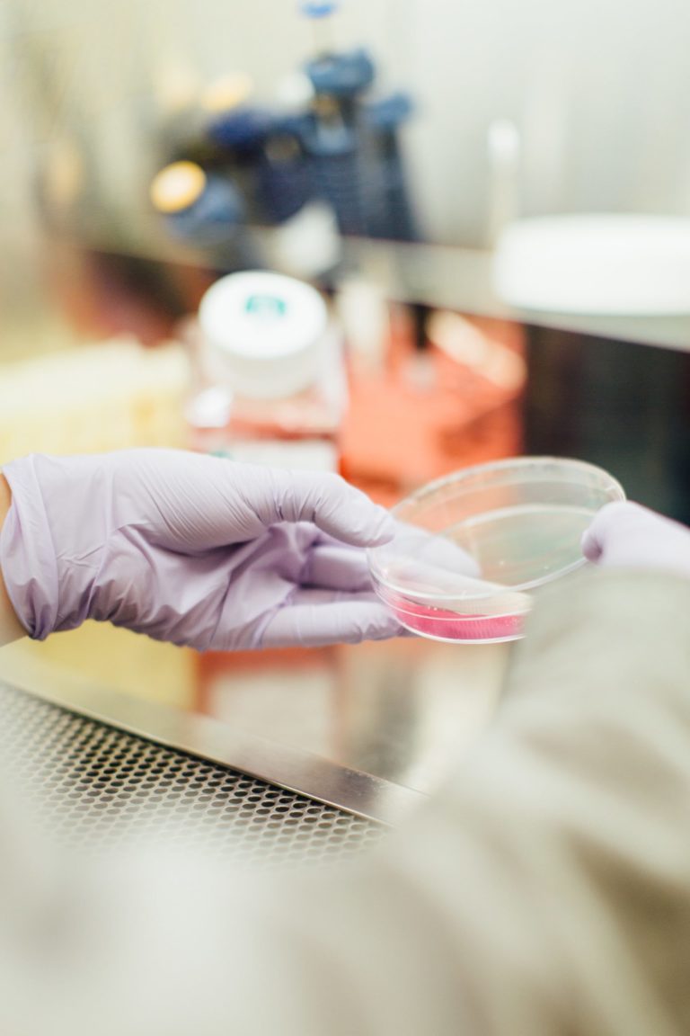 What Is the Difference Between Protein Expression and Protein Purification?